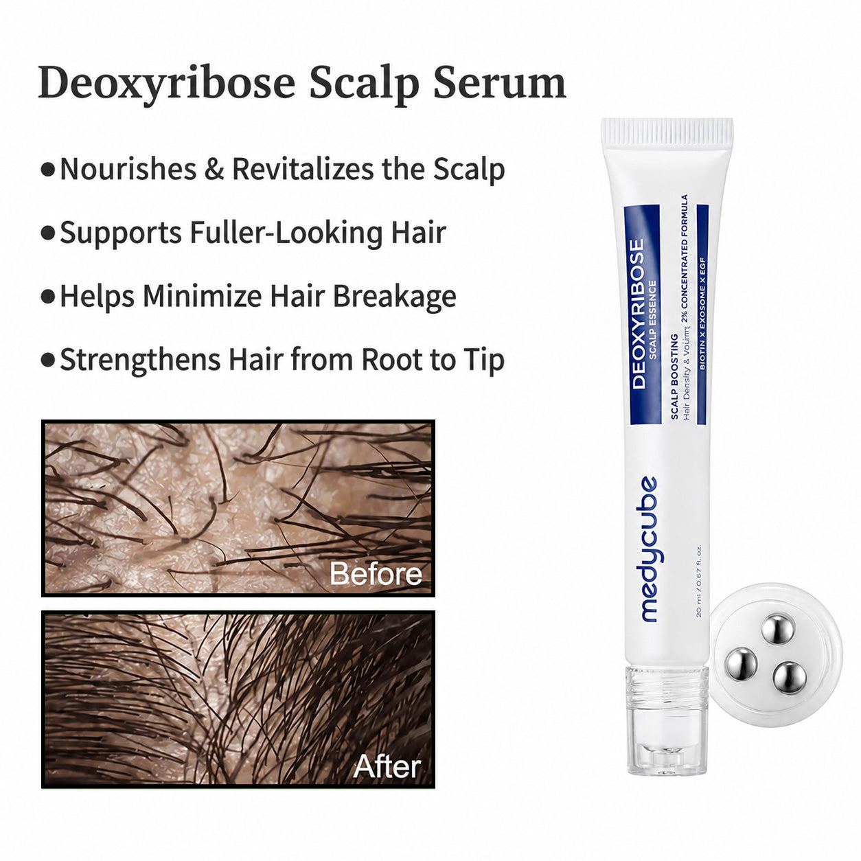 Deoxyribose Scalp Serum