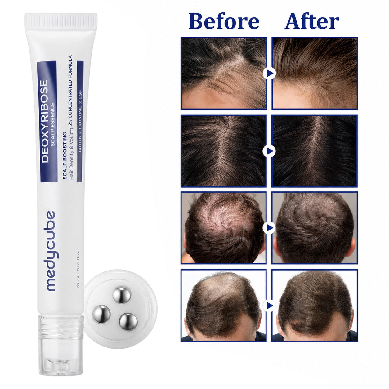 Deoxyribose Scalp Serum