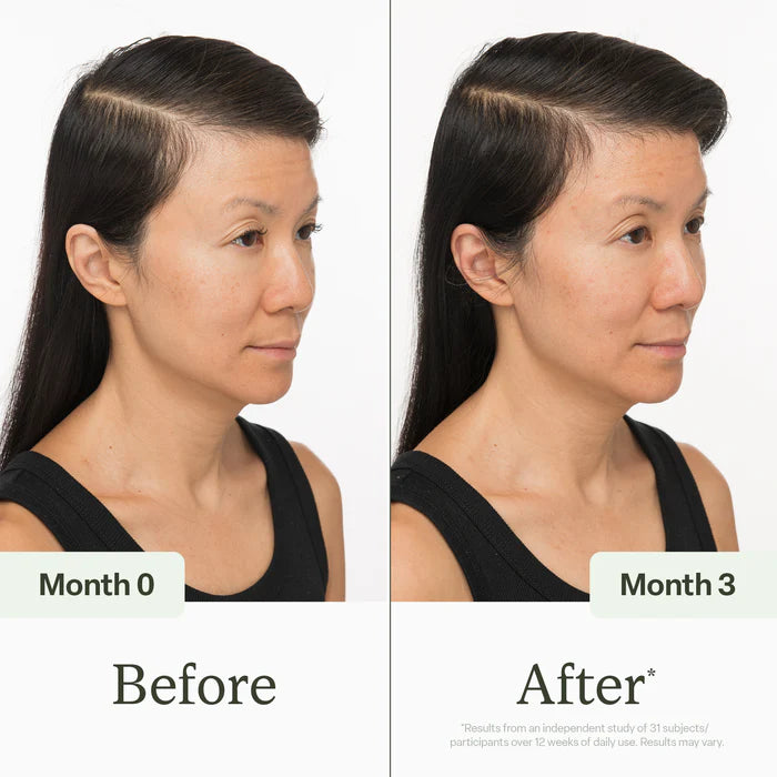 Deoxyribose Scalp Serum